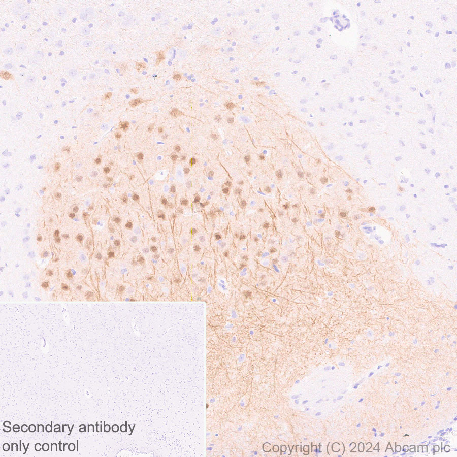 Immunohistochemistry (Formalin/PFA-fixed paraffin-embedded sections) - Anti-Ppp1r17 antibody [EPR29124-227] - BSA and Azide free (ab317832), expandable thumbnail