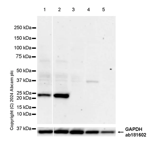 Western blot - Anti-Ppp1r17 antibody [EPR29124-227] - BSA and Azide free (AB317832)