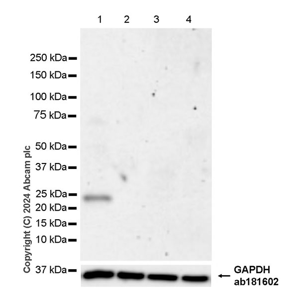 Western blot - Anti-Ppp1r17 antibody [EPR29124-227] - BSA and Azide free (ab317832), expandable thumbnail