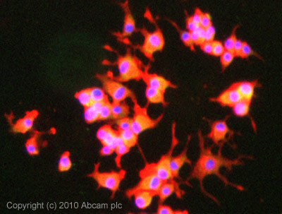 Immunocytochemistry/ Immunofluorescence - Anti-PPP1R1A antibody [EP902Y] (AB40877), expandable thumbnail