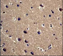 Immunohistochemistry (Formalin/PFA-fixed paraffin-embedded sections) - Anti-PPP1R1A antibody [EP902Y] (AB40877), expandable thumbnail