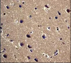 Immunohistochemistry (Formalin/PFA-fixed paraffin-embedded sections) - Anti-PPP1R1A antibody [EP902Y] (AB40877)