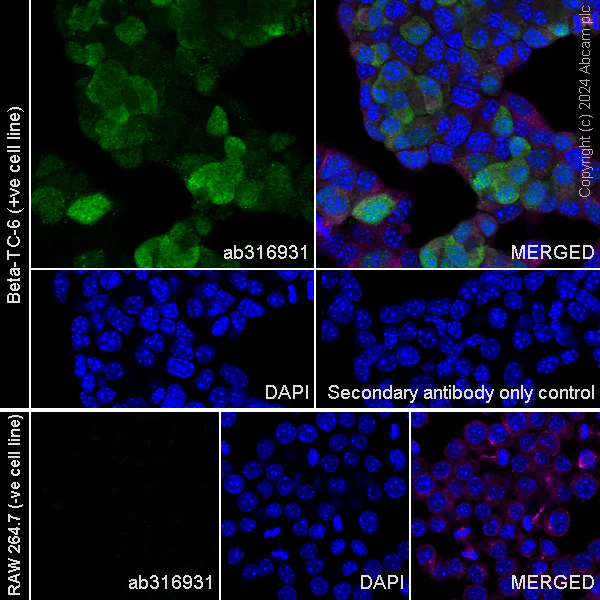 Immunocytochemistry/ Immunofluorescence - Anti-PPP1R1A antibody [EPR28192-90] - BSA and Azide free (AB316932)