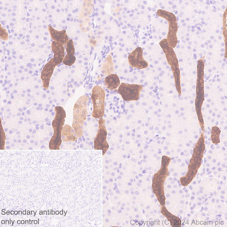 Immunohistochemistry (Formalin/PFA-fixed paraffin-embedded sections) - Anti-PPP1R1A antibody [EPR28192-90] - BSA and Azide free (AB316932)
