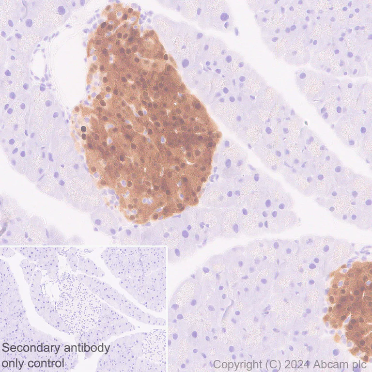 Immunohistochemistry (Formalin/PFA-fixed paraffin-embedded sections) - Anti-PPP1R1A antibody [EPR28192-90] - BSA and Azide free (AB316932)