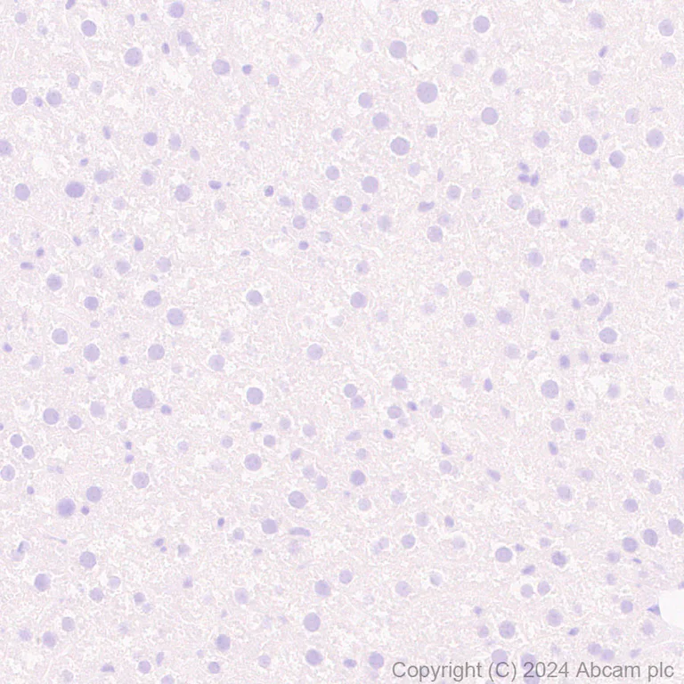 Immunohistochemistry (Formalin/PFA-fixed paraffin-embedded sections) - Anti-PPP1R1A antibody [EPR28192-90] - BSA and Azide free (AB316932)
