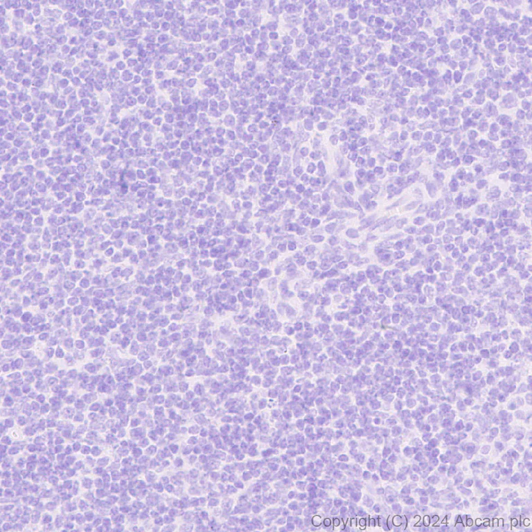 Immunohistochemistry (Formalin/PFA-fixed paraffin-embedded sections) - Anti-PPP1R1A antibody [EPR28192-90] - BSA and Azide free (AB316932)