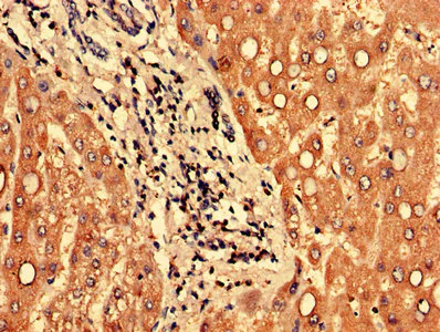 Immunohistochemistry (Formalin/PFA-fixed paraffin-embedded sections) - Anti-PPP1R3B antibody (AB235049)