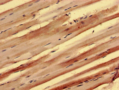 Immunohistochemistry (Formalin/PFA-fixed paraffin-embedded sections) - Anti-PPP1R3B antibody (AB235049)