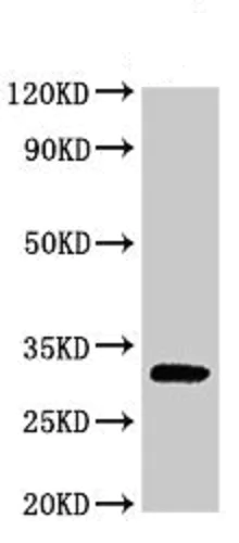 Western blot - Anti-PPP1R3B antibody (AB235049)