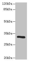 Western blot - Anti-PPP1R3B antibody (AB235049)