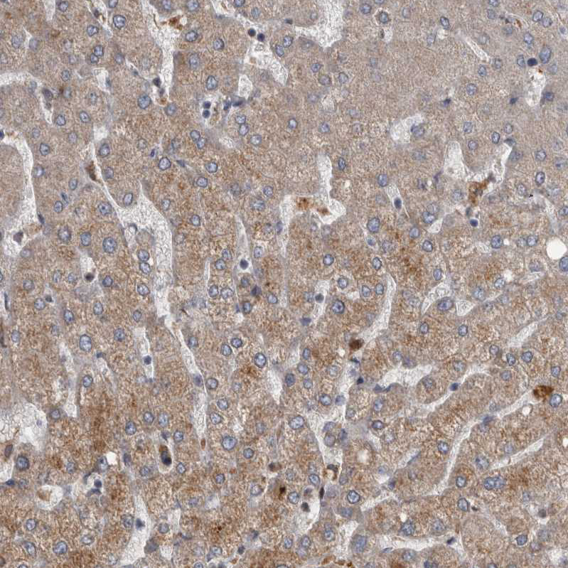 Immunohistochemistry (Formalin/PFA-fixed paraffin-embedded sections) - Anti-PPP1R3C antibody (AB251771), expandable thumbnail