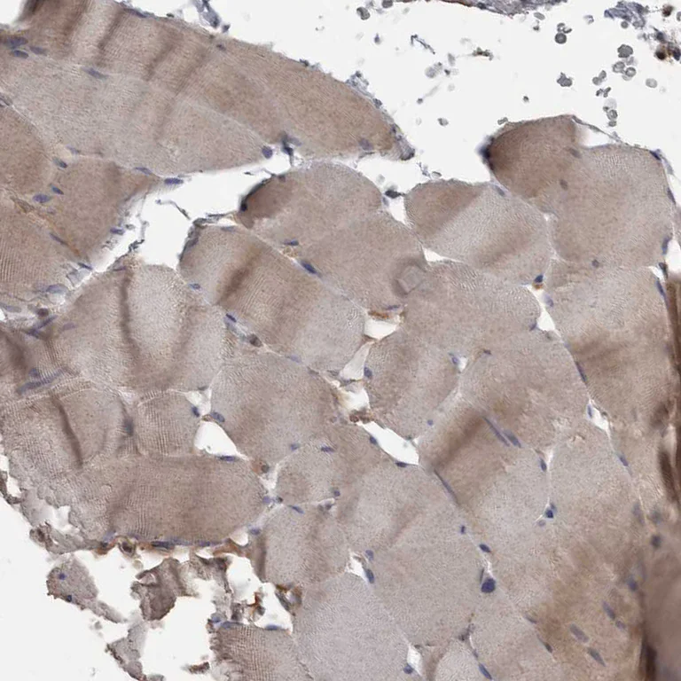 Immunohistochemistry (Formalin/PFA-fixed paraffin-embedded sections) - Anti-PPP1R3C antibody (AB251771)