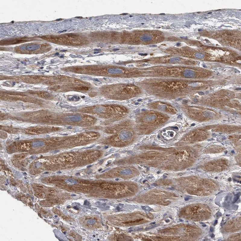 Immunohistochemistry (Formalin/PFA-fixed paraffin-embedded sections) - Anti-PPP1R3C antibody (AB251771), expandable thumbnail