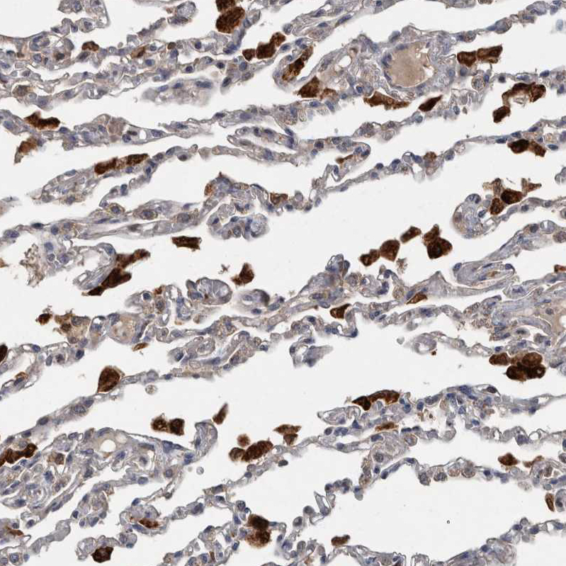 Immunohistochemistry (Formalin/PFA-fixed paraffin-embedded sections) - Anti-PPP1R3C antibody (AB251771), expandable thumbnail