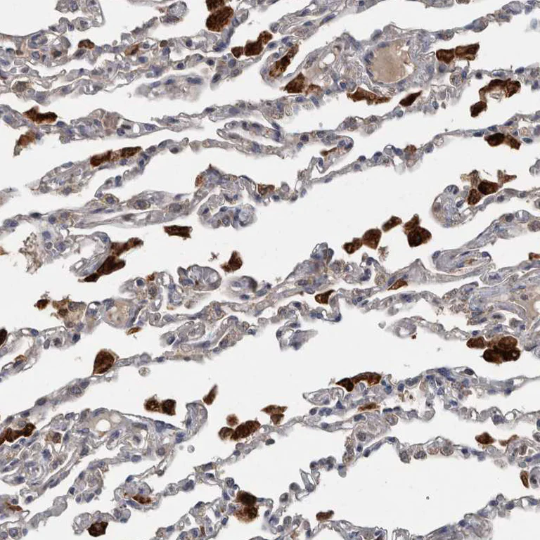 Immunohistochemistry (Formalin/PFA-fixed paraffin-embedded sections) - Anti-PPP1R3C antibody (AB251771)