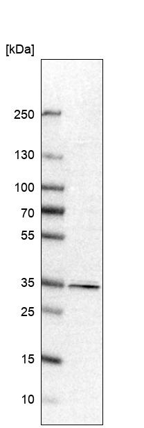 Western blot - Anti-PPP1R3C antibody (AB251771), expandable thumbnail