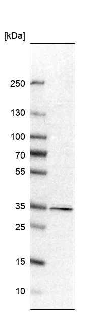 Western blot - Anti-PPP1R3C antibody (AB251771)