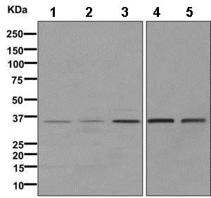 Western blot - Anti-PPP2CB antibody [EPR11786(B)] (AB168371)