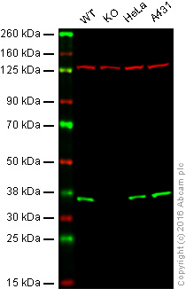Western blot - Anti-PPP2CB antibody [EPR11786(B)] (AB168371)