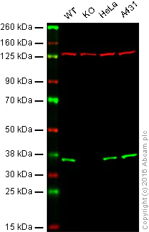 Western blot - Anti-PPP2CB antibody [EPR11786(B)] (AB168371)
