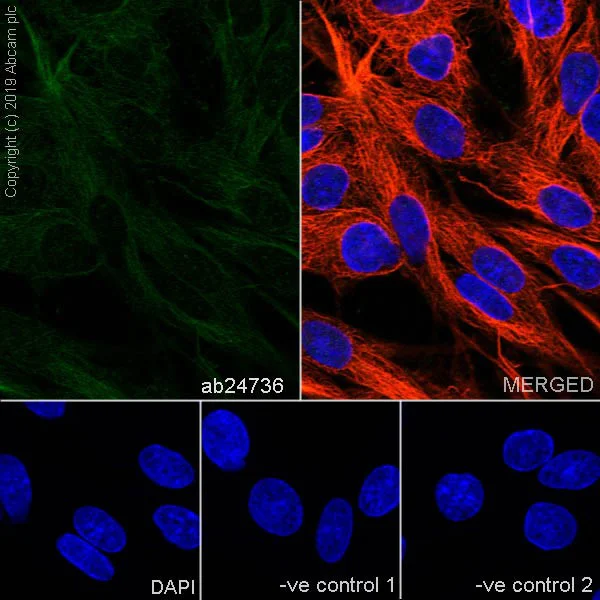 Immunocytochemistry/ Immunofluorescence - Anti-PPP2R1A antibody [6G3] (AB24736)
