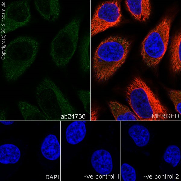 Immunocytochemistry/ Immunofluorescence - Anti-PPP2R1A antibody [6G3] (AB24736)