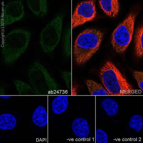Immunocytochemistry/ Immunofluorescence - Anti-PPP2R1A antibody [6G3] (AB24736)