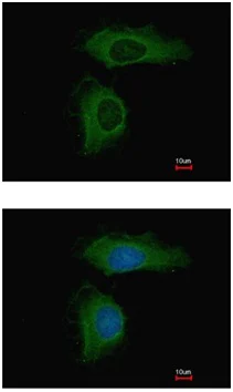 Immunocytochemistry/ Immunofluorescence - Anti-PPP2R1A antibody (AB154551)