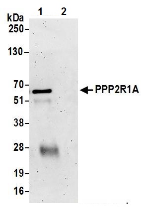 Immunoprecipitation - Anti-PPP2R1A antibody (AB245622)