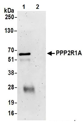 Anti-PPP2R1A antibody (ab245622) | Abcam
