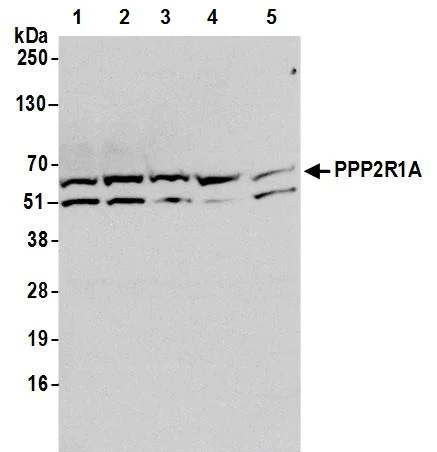 Western blot - Anti-PPP2R1A antibody (AB245622)