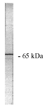Western blot - Anti-PPP2R1A + PPP2R1B antibody (AB28350)