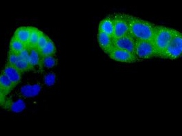 Immunocytochemistry/ Immunofluorescence - Anti-PPP2R1B antibody [EPR10158] (ab154815), expandable thumbnail