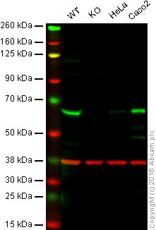 Western blot - Anti-PPP2R1B antibody [EPR10158] (AB154815), expandable thumbnail