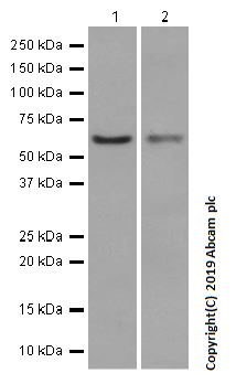 Western blot - Anti-PPP2R1B antibody [EPR10158] (AB154815), expandable thumbnail
