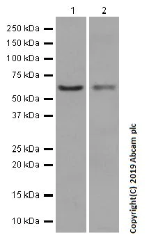 Western blot - Anti-PPP2R1B antibody [EPR10158] (AB154815)