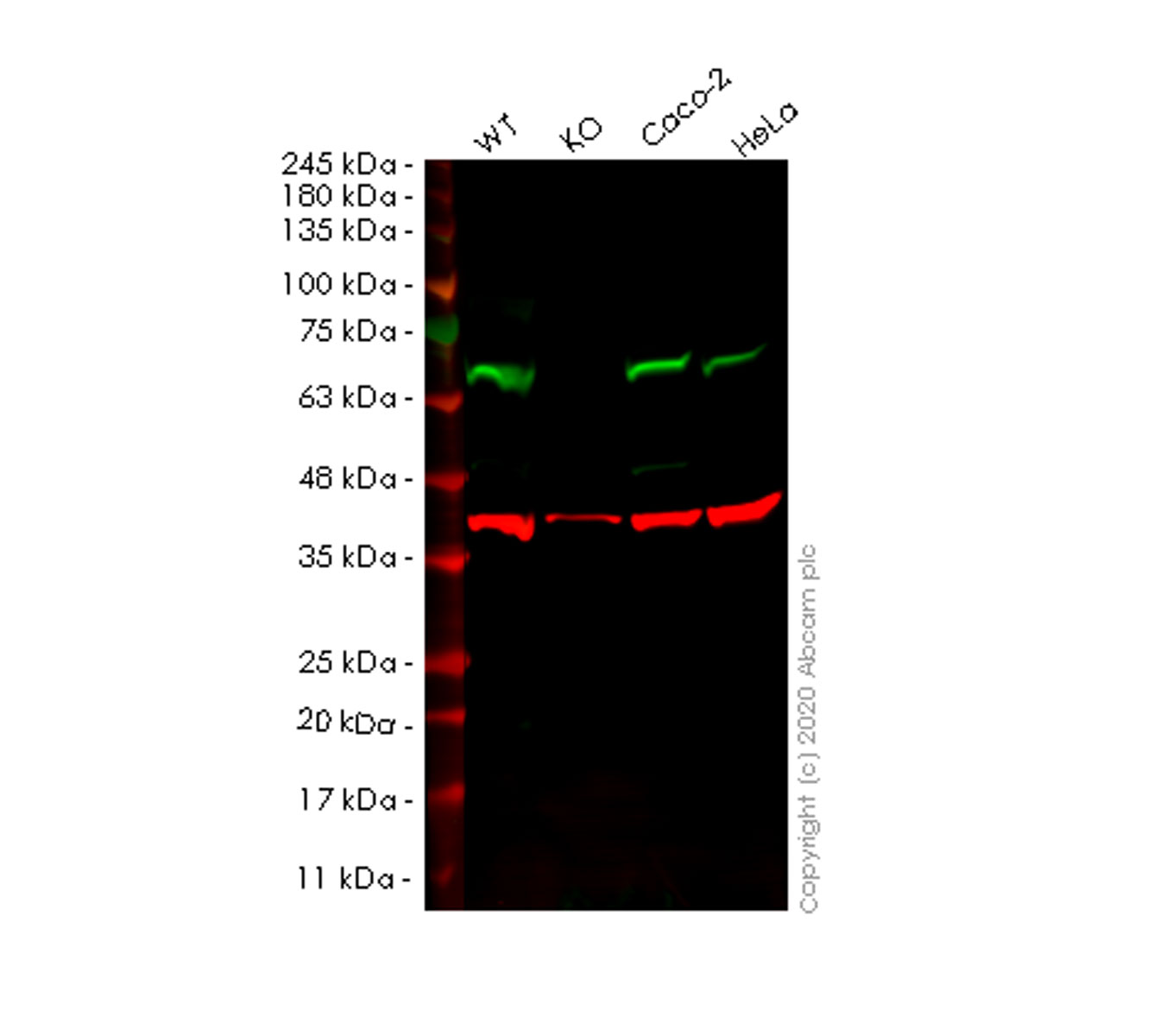 Western blot - Anti-PPP2R1B antibody [EPR10158] (AB154815), expandable thumbnail