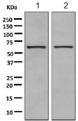 Western blot - Anti-PPP2R1B antibody [EPR10158] (AB154815), expandable thumbnail