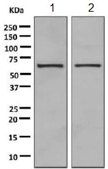Western blot - Anti-PPP2R1B antibody [EPR10158] (AB154815)