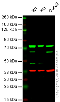Western blot - Anti-PPP2R1B antibody [EPR10159] (AB154833), expandable thumbnail