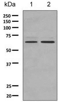 Western blot - Anti-PPP2R1B antibody [EPR10159] (AB154833), expandable thumbnail