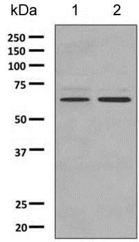 Western blot - Anti-PPP2R1B antibody [EPR10159] (AB154833)