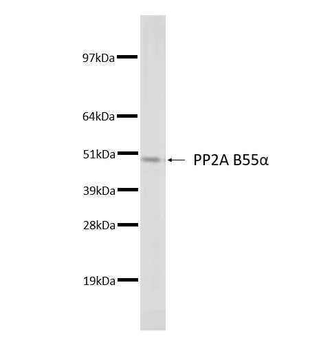 Western blot - Anti-PPP2R2A Antibody [2G9] (AB316367)