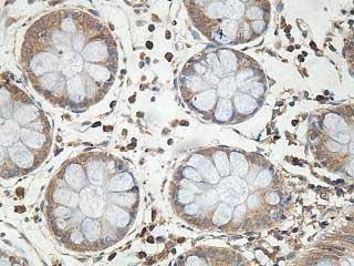 Immunohistochemistry (Formalin/PFA-fixed paraffin-embedded sections) - Anti-PPP2R2A antibody (AB197194), expandable thumbnail