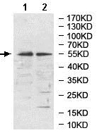 Western blot - Anti-PPP2R2A antibody (AB197194)