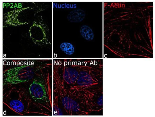 Immunocytochemistry/ Immunofluorescence - Anti-PPP2R2A Antibody [RP23040118] (AB313413)