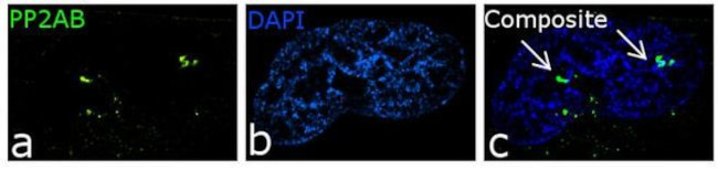 Immunocytochemistry/ Immunofluorescence - Anti-PPP2R2A Antibody [RP23040118] (AB313413)