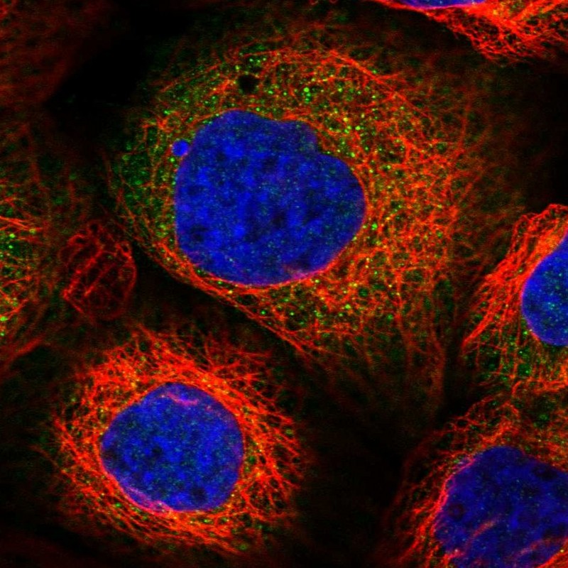 Immunocytochemistry/ Immunofluorescence - Anti-PPP2R2B antibody (AB251885), expandable thumbnail