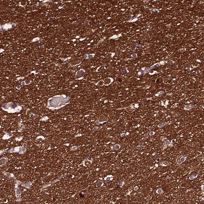 Immunohistochemistry (Formalin/PFA-fixed paraffin-embedded sections) - Anti-PPP2R2B antibody (AB251885), expandable thumbnail